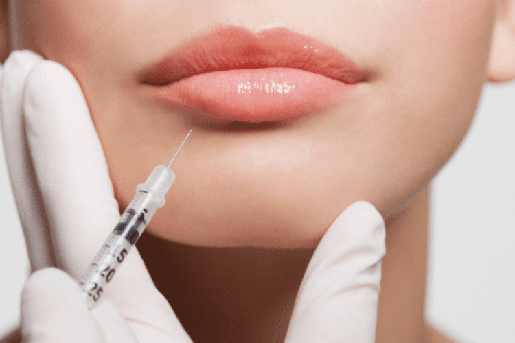 Dos And Don’ts Before And After Lip Filler Treatments