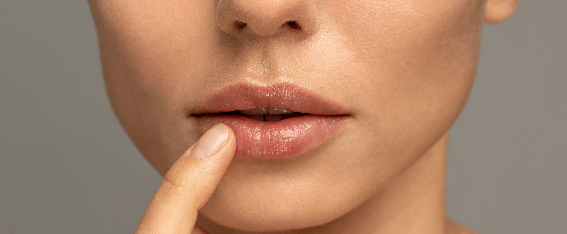 Woman with full lips after getting lip fillers at DermaMedica, Marlow