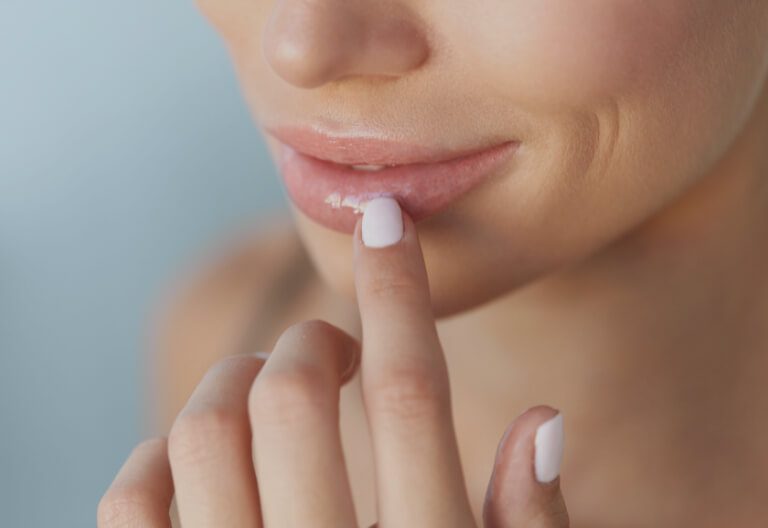 close up of woman touching her lip dermal fillers