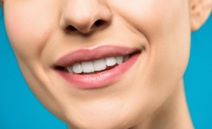 Lip filler aftercare at Derma Medica, Knightsbridge